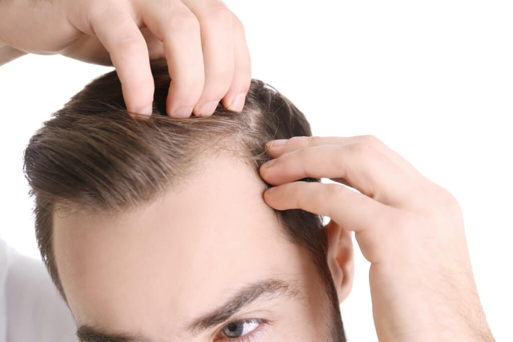 Modern methods of hair restoration for alopecia Modern methods of hair restoration for alopecia