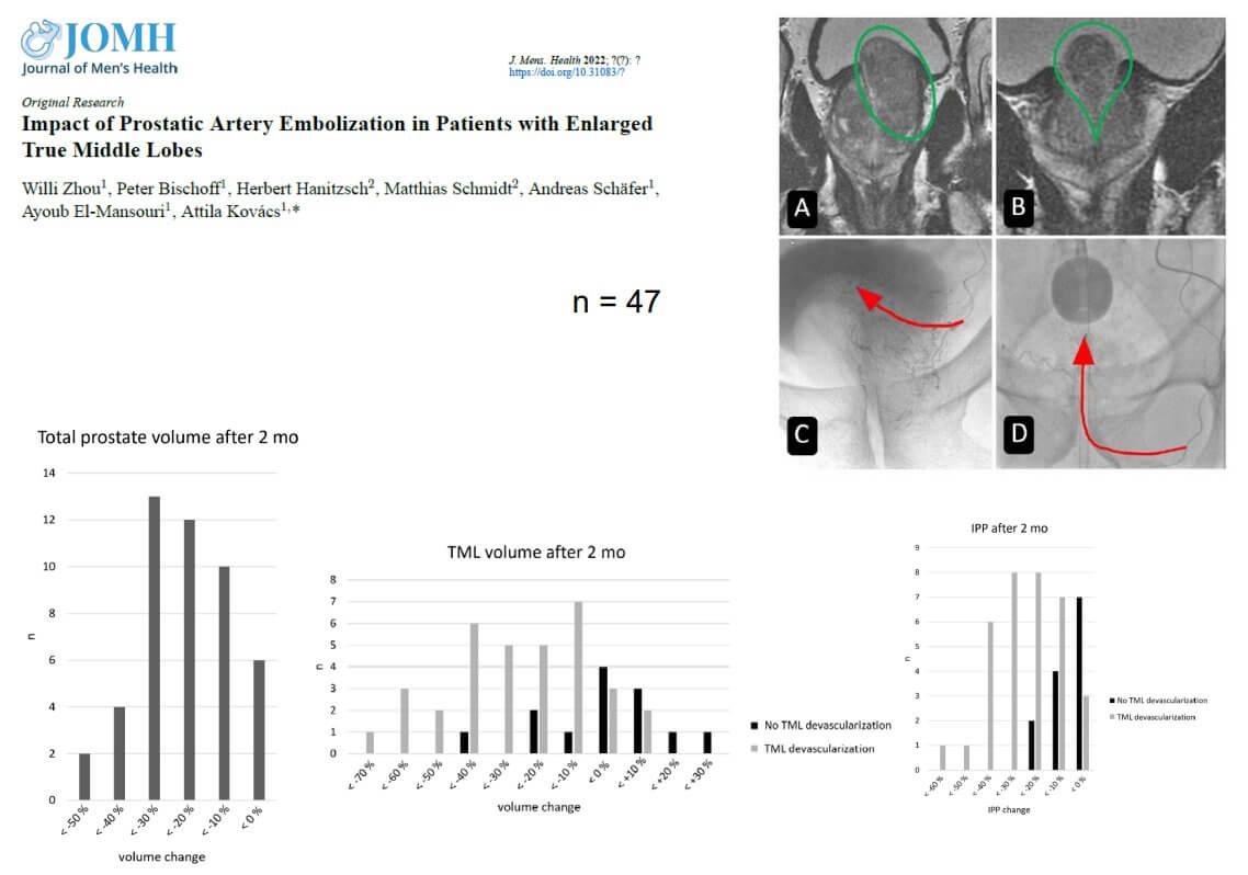 Impact of PAE