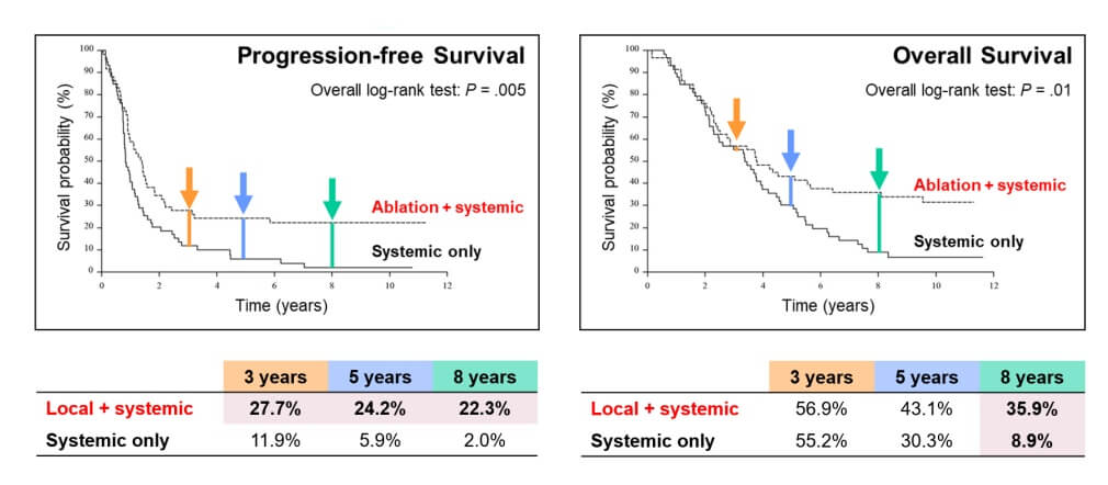 Локальное лечение нерезектабельных колоректальных метастазов в печени