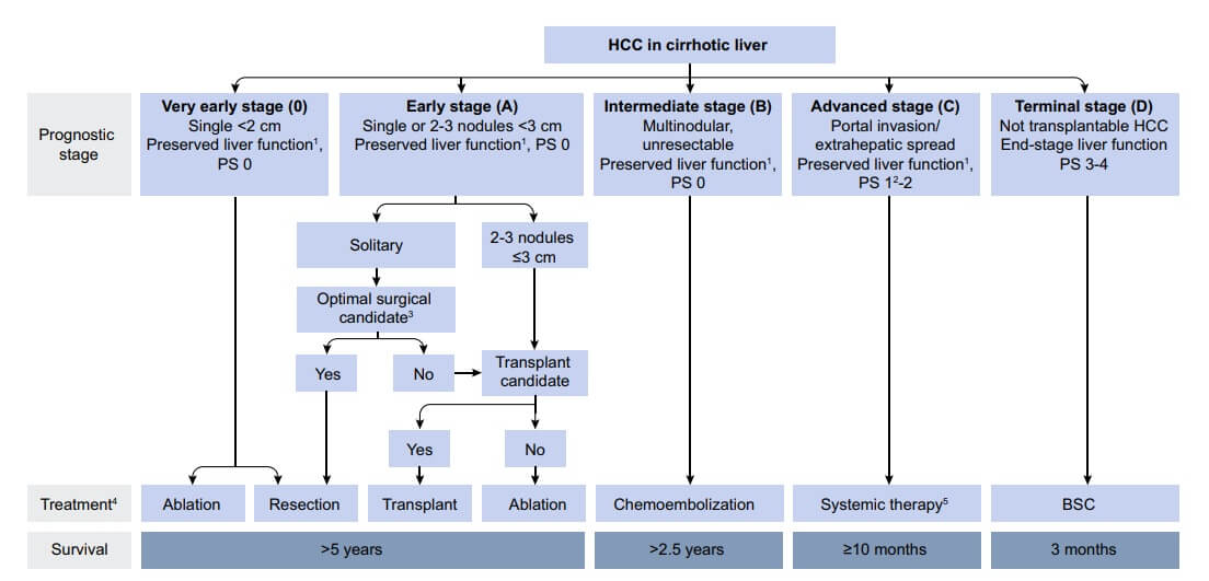 Modified BCLC staging system and treatment strategy
