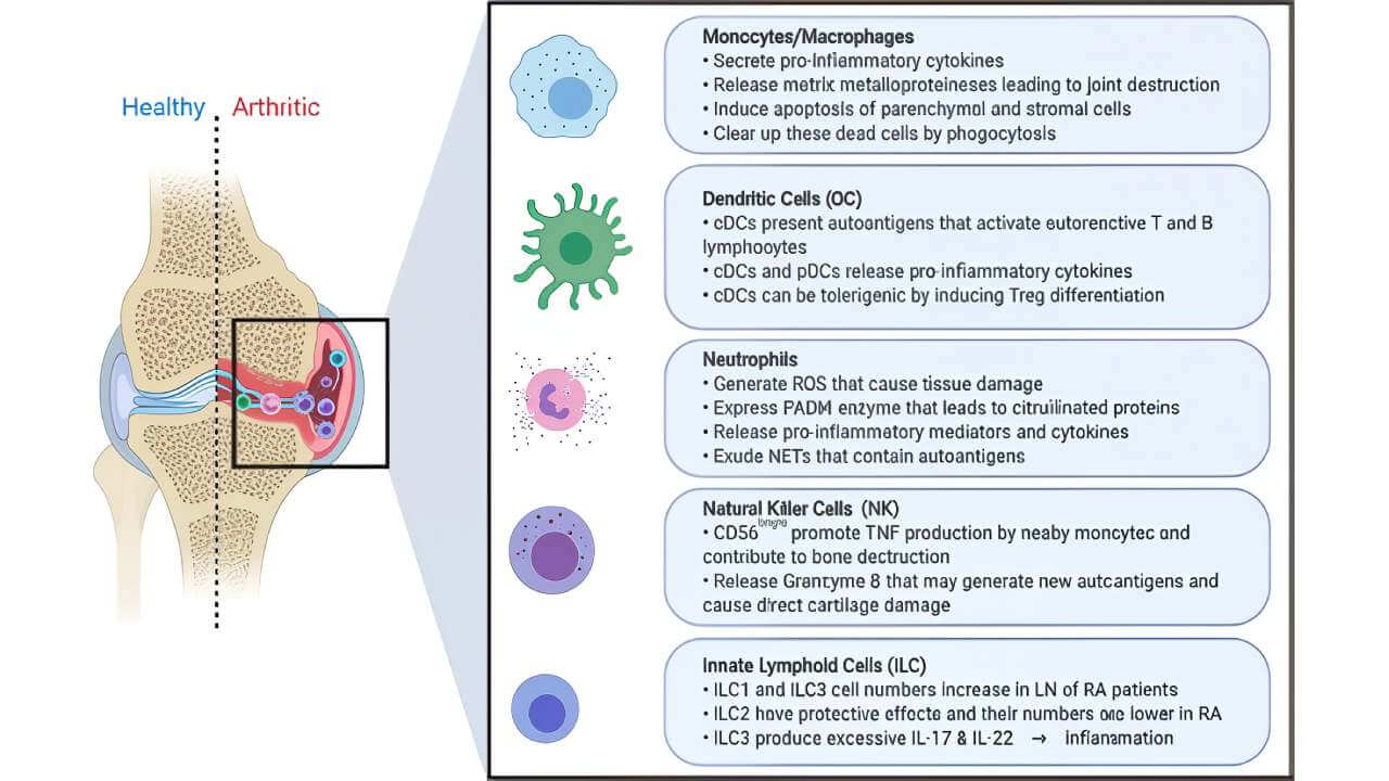 RA Pathogenesis