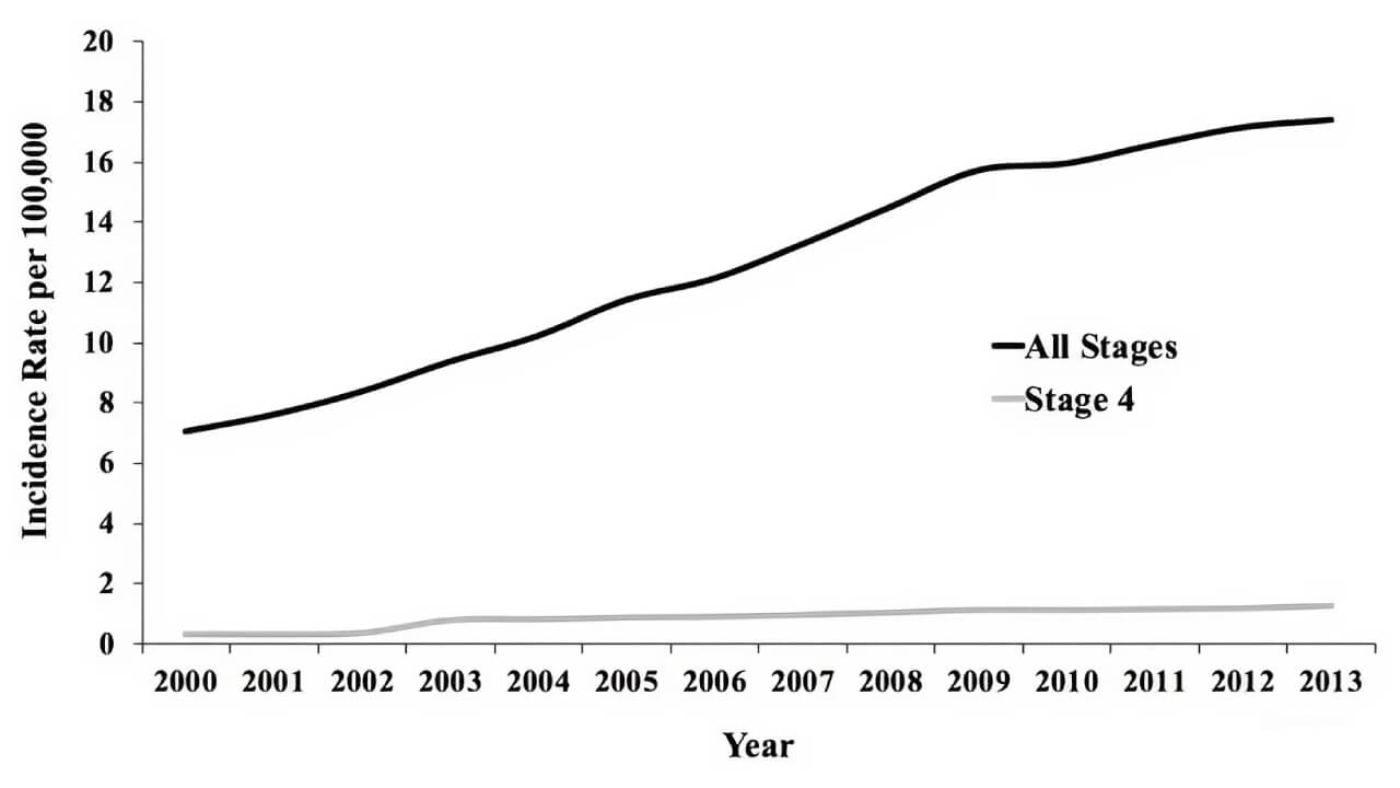 Trends in Incidence of Thyroid Cancer (2000-2013) in the United States
