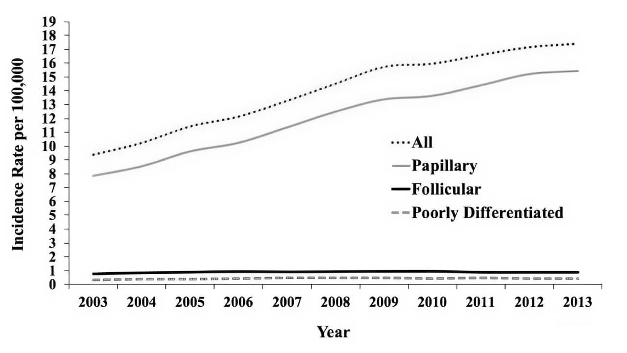 Trends in Incidence of Thyroid Cancer (2003-2013) in the United States by Histology