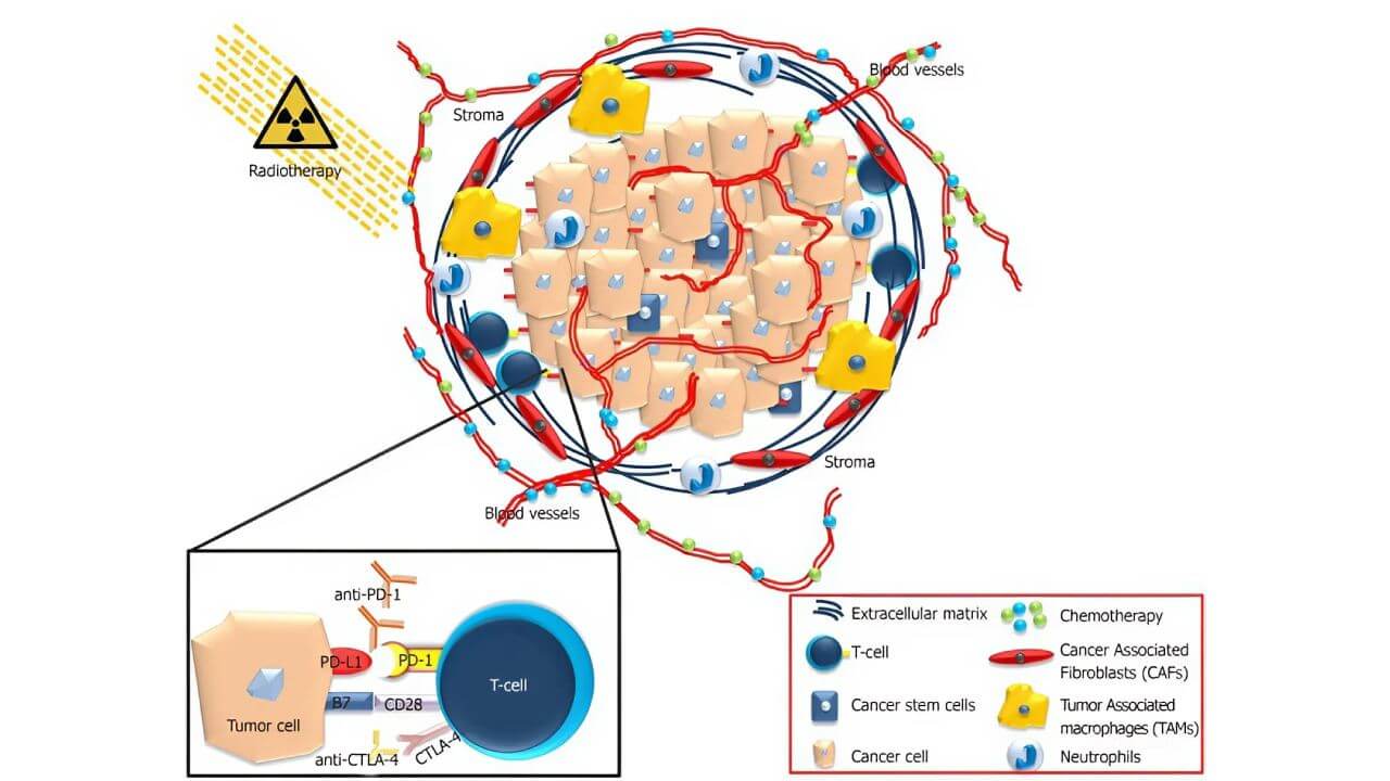Pancreatic Ductal Adenocarcinoma Microenvironment: Treatment Hurdles
