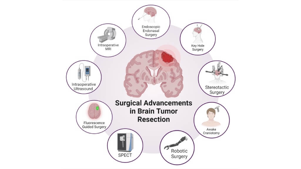 Overview of Radiological and Surgical Advancements in Neurosurgery for Brain Tumor Resection